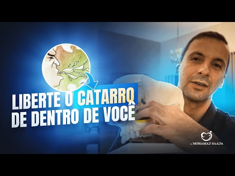 CATARRO PRESO DENTRO DE VOCÊ. DOR DE CABEÇA. TOSSE. CATARRO NA GARGANTA. SAIBA COMO RESOLVER