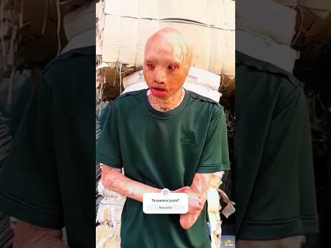Salv贸 a su novia de un incendio y ella lo abandon贸 馃槰