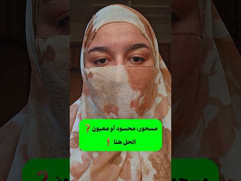 ู
ุณุญูุฑุ ู
ุญุณูุฏ ุฃู ู
ุนูููโ๏ธุงูุญู ููุง โ๏ธ