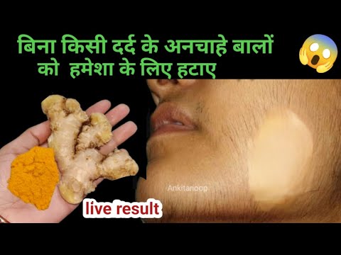 अदरक के रस में इसे मिलाकर लगाया🤔अनचाहे बाल झड़ के गिरने लगेंगे 😱100%|| facial hair