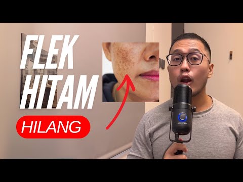 Tips untuk FLEK HITAM