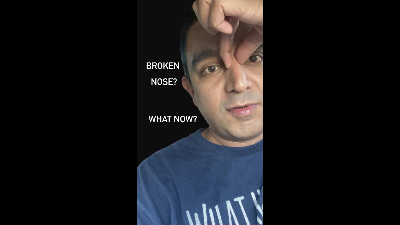 Man expressing concern about a potential broken nose.