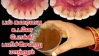 1பைசா செலவில்லாமல் பற்களில் உள்ள கறையை நீக்கிடலாம்😬/ Whitening teeth home remedies #Howtowhitenteeth