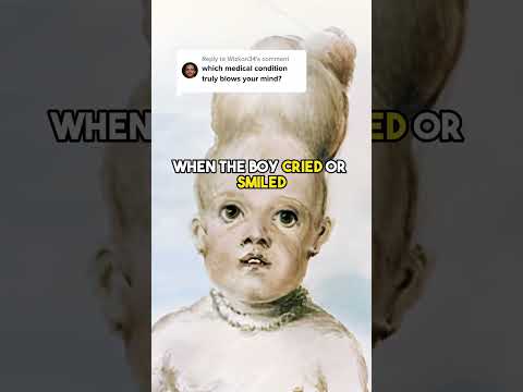 A Medical Condition That Truly Blows My Mind