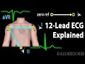 ECG and Electrical Activities of the Heart