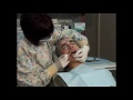 Periodontal Abscess Understanding and Management