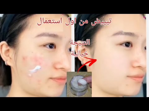 أقسم بالله كريم ملكي واخا تكوني كحلة تبياضي. تبييض من اول استعمال مجربة ومضمونة 100٪ وجهك يرجع مرايا