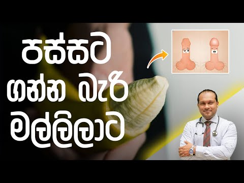 පස්සට ගන්න බැරි මල්ලිලාට - Dr. Namal Wijesinghe