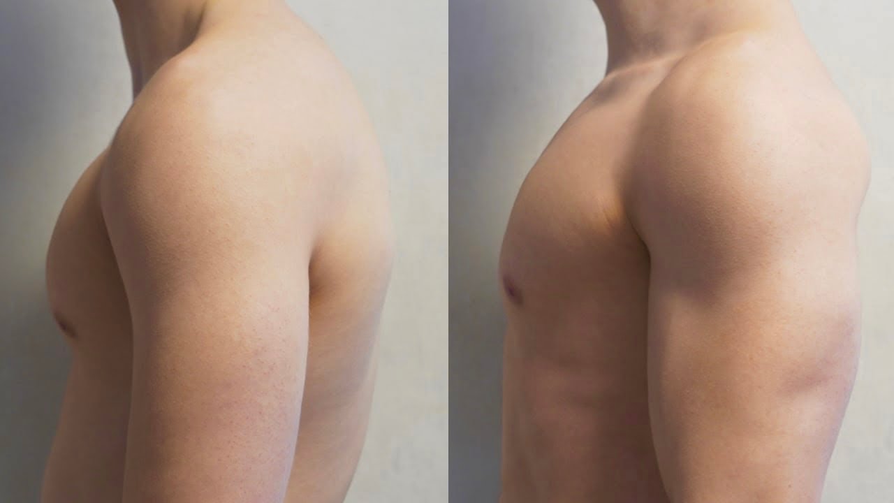 Fix Shoulders in 14 DAYS! ( Home Exercises )