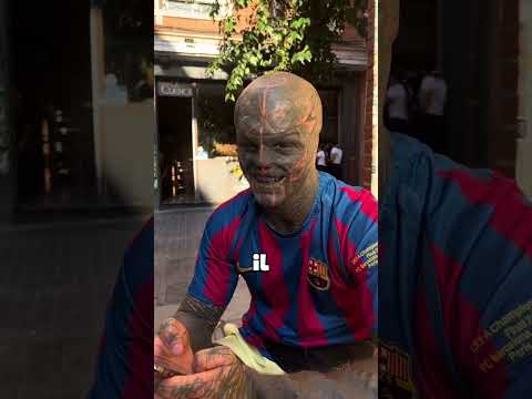 Antony le Fredo dit Black Alien 👽 pleure et regrette de ses tatouages.