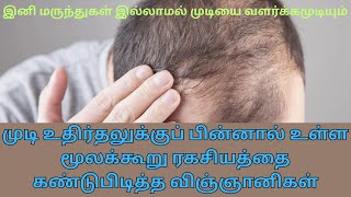 முடி உதிர்தலுக்குப் பின்னால் உள்ள மூலக்கூறு ரகசியத்தை கண்டுபிடித்த விஞ்ஞானிகள்