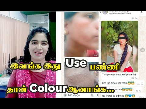 இவங்க இத Use பண்ணி தான்  கலர் ஆனாங்க | Full Body Whitening at Home 100% natural Live Result