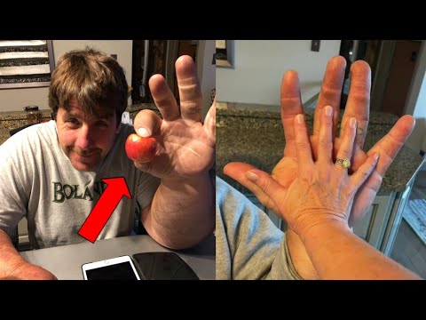 Real Life Popeye | Biggest hand in world 🌍 | Mad 4 Muscles