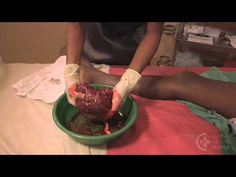 Examining the Placenta - Childbirth Series