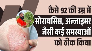 कैसे 92 की उम्र में सोरायसिस (Psoriasis), अल्जाइमर जैसी कई समस्याओं को ठीक किया || Swami Ramdev