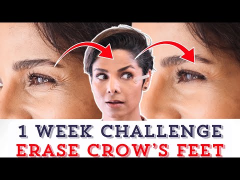 Reduce CROW'S FEET around Eyes with FACE YOGA/ Worth Trying This 1 WEEK CHALLENGE