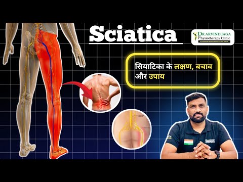 Sciatica क्या है | इससे कैसे बचा जा सकता है | Arvind Jaga #physiotherapist | exercise for back pain