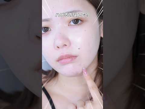 コンシーラーしてもニキビ隠れない子集合‼️塗り方変えるだけで頑固なニキビともおさらば👋🏻