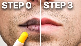 Why Your Lips Are ALWAYS Dry (Dermatologist)
