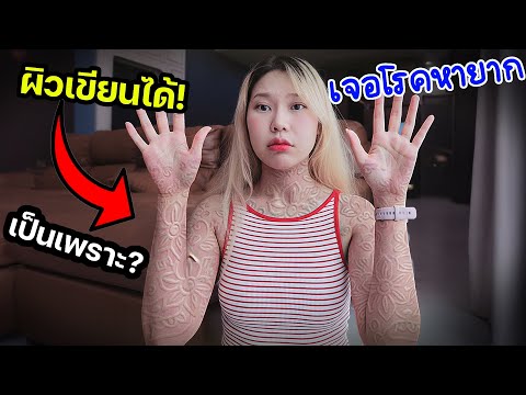 ป่วยเป็นโรคหายาก เพราะออกกำลังกายหนัก มีจริง?