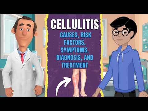 Cellulitis:  Causes, Risk factors, Symptoms, Diagnosis, and Treatment (Clear Explanation)