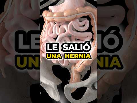 💥 👉🏻 A GOMITA le SALIÓ una HERNIA 🪱 en los INTESTINOS 😭