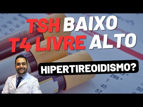 TSH BAIXO, T4 LIVRE ALTO - HIPERTIREOIDISMO POR DOENÇA DE GRAVES