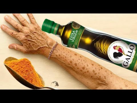 SÓ LAVO MÃOS COM MANCHAS PRETAS E BRANCAS ASSIM/DESGRUDA RUGAS DE ATÉ 80 ANOS na PELE