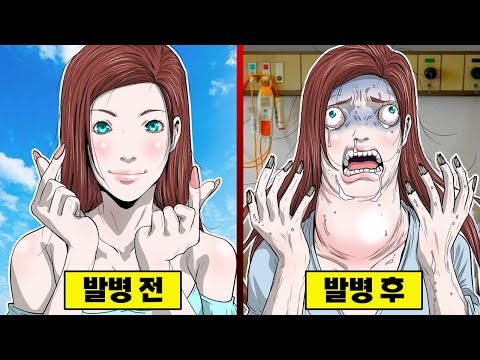 【만화】 몸이 붕괴되는 병... 눈알이 튀어나오고 손톱이 전부 갈라지다