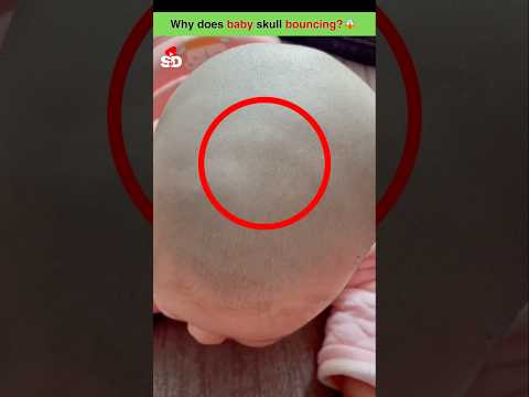 Why does new baby skull bouncing? 😱