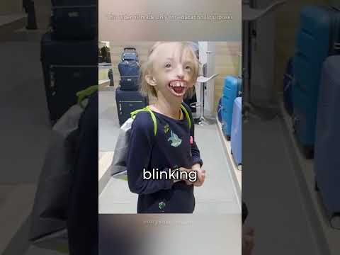 The World’s Rarest Kids With Incredible Bodies😱😳