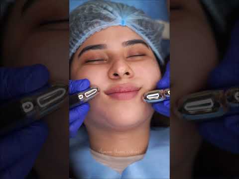 Hydra Facial ✨