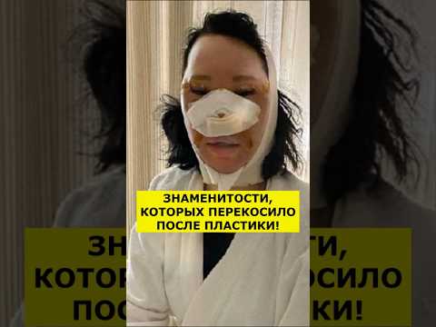 ШОК! ЭТИ ЗВЁЗДЫ СТАЛИ ЖЕРТВАМИ ПЛАСТИКИ