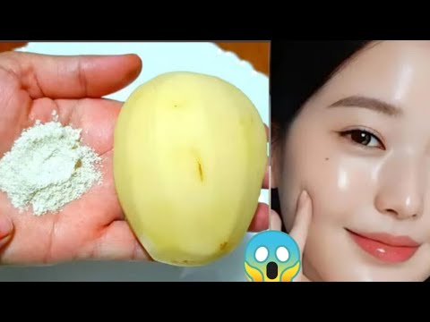 रात में सोने से पहले आलू के रस में बस ये 1 चीज मिलाकर लगालो चेहरा चमकने लगेगा skin whitening Potato,