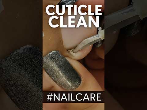 빠져드네~🙀 Foot Cuticle Removal｜Clean Toenail Transformation #피부관리 #footcare #pimplepopping #pimple