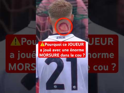 C’est QUOI ce TRUC ? 😱 #football #seriea #mystere #maillot #italie #psg #messi #cr7