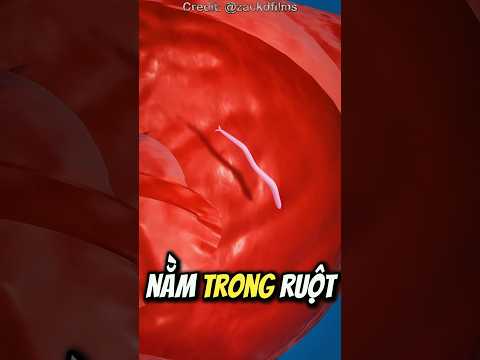 Nếu Bạn Bị Giun Móc 😨 (Bỏ Thói Quen Đi Chân Đất Ngay)