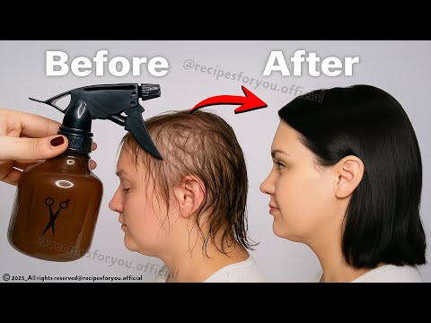 Hair Grows Like Crazy! Top 4 Natural Remedies to Stop Hair Loss Fast!