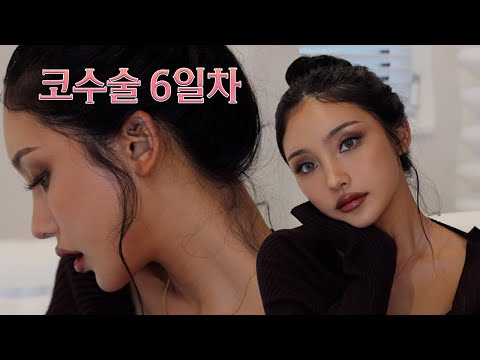 믿기지 않겠지만 코 수술 6일 차👃🏽 겟레디윗미  당사자도 안 믿겨요 / jella 젤라