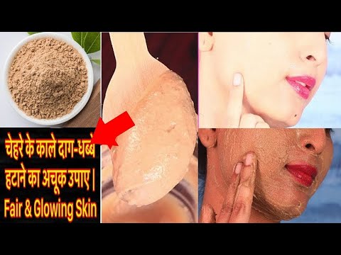 सिर्फ 1 बार में Parlor से बेहतर Tan Removal स्किन को गोरा करने के नेचुरल और मेडिकल तरीके घर पर करें