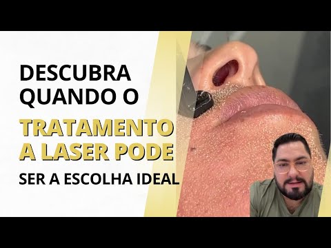 Descubra quando o tratamento a laser pode ser a escolha ideal