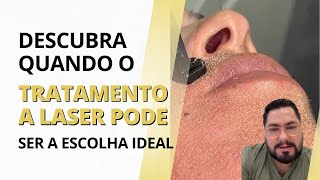 Descubra quando o tratamento a laser pode ser a escolha ideal