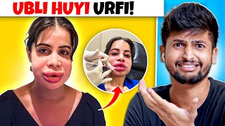 URFI JAVED LIP FILLERS GONE WRONG 😨