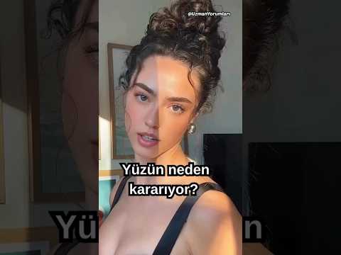 Yüzün neden kararıyor?🌓