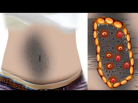 ASMR Dirty Belly Cleaning