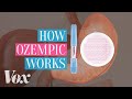 Understanding Ozempic and Its Implications