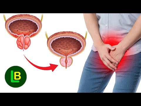 SPAS ZA PROSTATU - 7 najboljih sastojaka da se smanji uvećana prostata