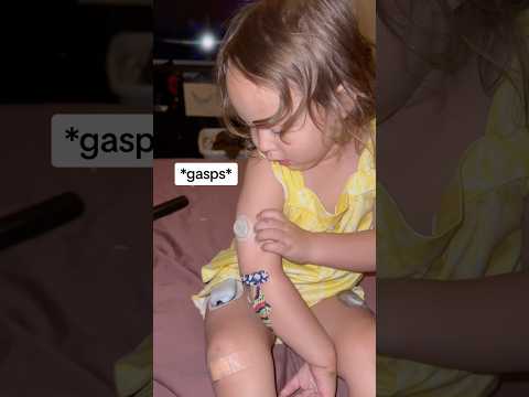 SHE HAD NO IDEA SHE WAS WEARING 4 DEVICES! #T1D #DIABETICTODDLER