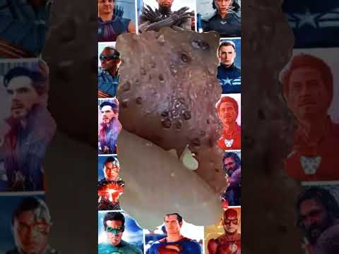 Big Cystic Acne Blackheads Extraction Blackheads & Milia, Whiteheads Removal Pimple Popping