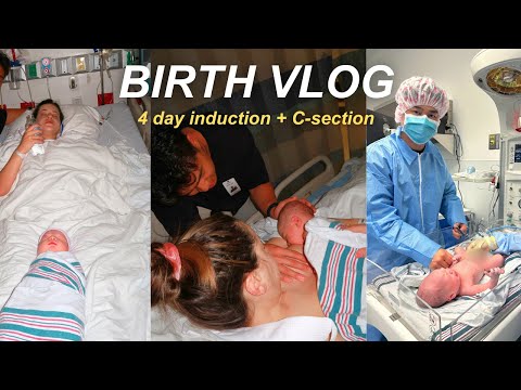 BIRTH VLOG *RAW* 🐣 4 day failed induction ending in emergency C-section | IVF live birth